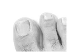 TERBINAFIN-1A Pharma Nagell.g.Nagelpilz 78,22 mg/ml, 3,3 ml