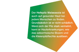 KETOZOLIN Szampon 2%, 60 ml