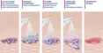 Instructions for use for MediGel® spray do czyszczenia ran, 50 ml - 6