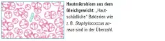 Instructions for use for AKTIVADERM ND Aktywne probiotyki do leczenia neurodermitów, 125 g - 2